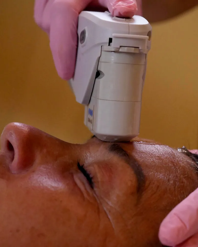 Trattamento di estetica avanzata Kelda