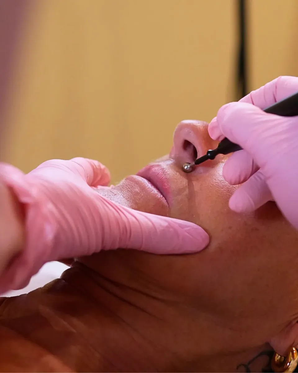 Trattamento di estetica avanzata Kelda