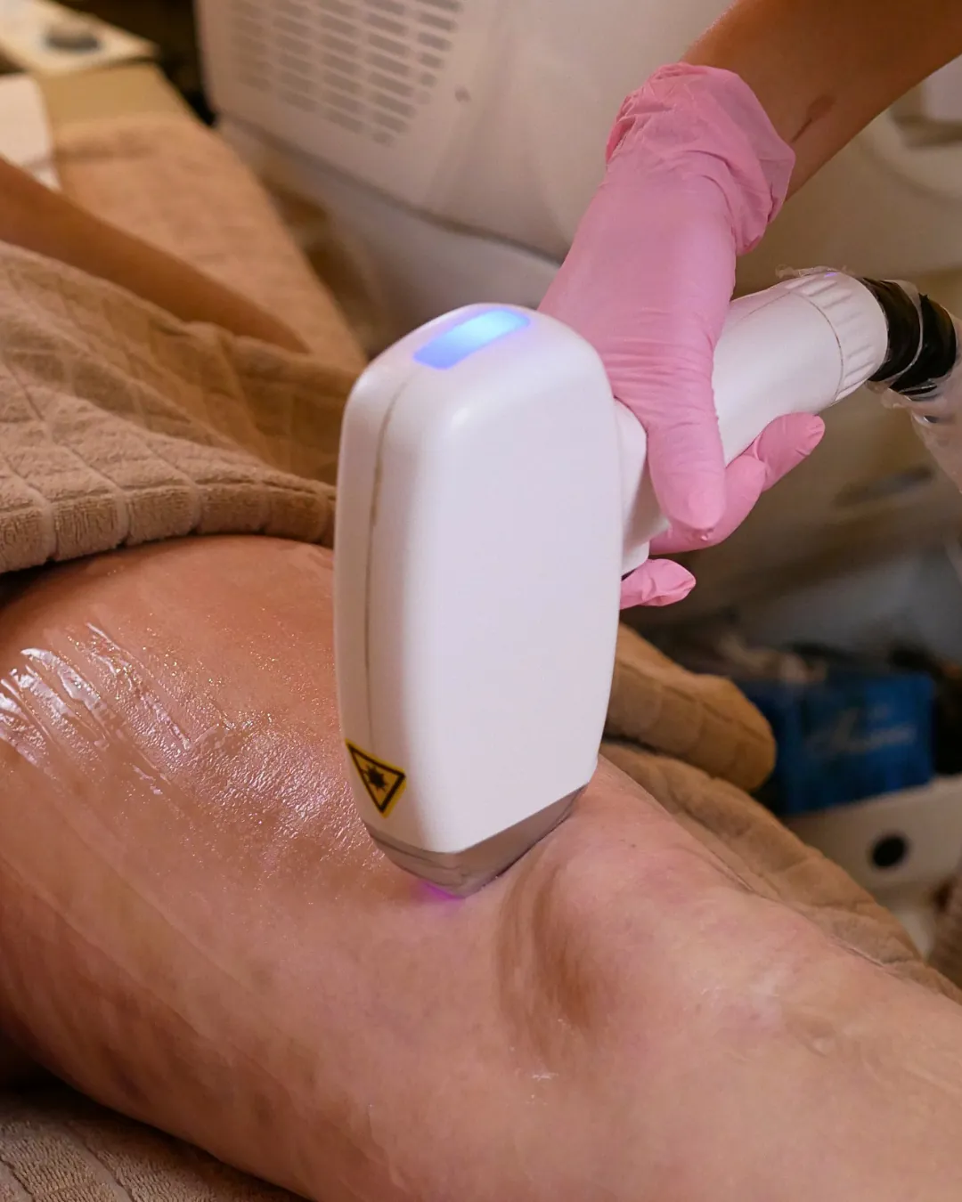 Laser estetico Kelda