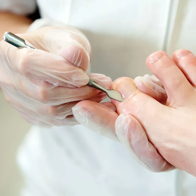 Pedicure curativo Kelda