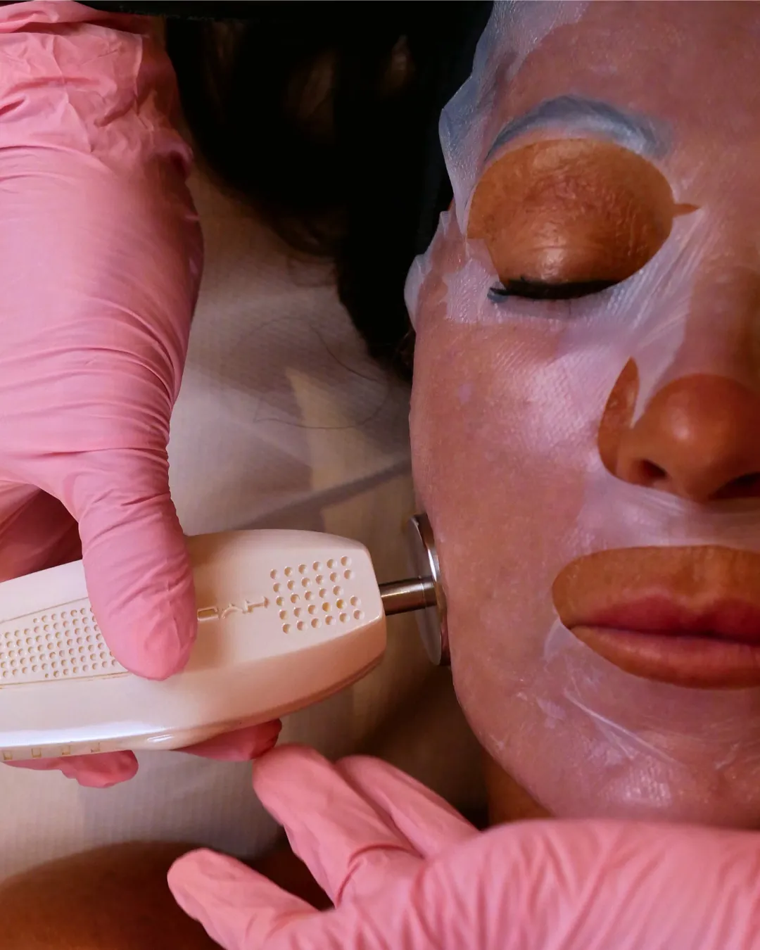 Percorsi viso di estetica avanzata Kelda