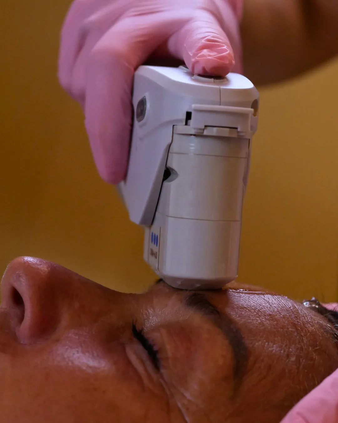 Trattamento viso di estetica avanzata Kelda